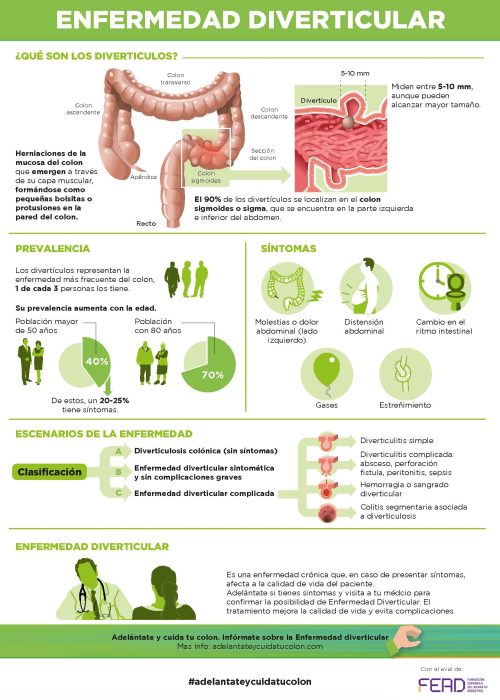 Enfermedad diverticular